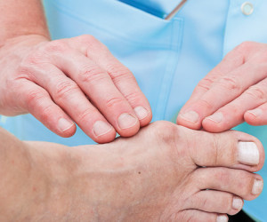 Vorschaubild Fußbeschwerden. Hallux valgus und Hammerzehen.